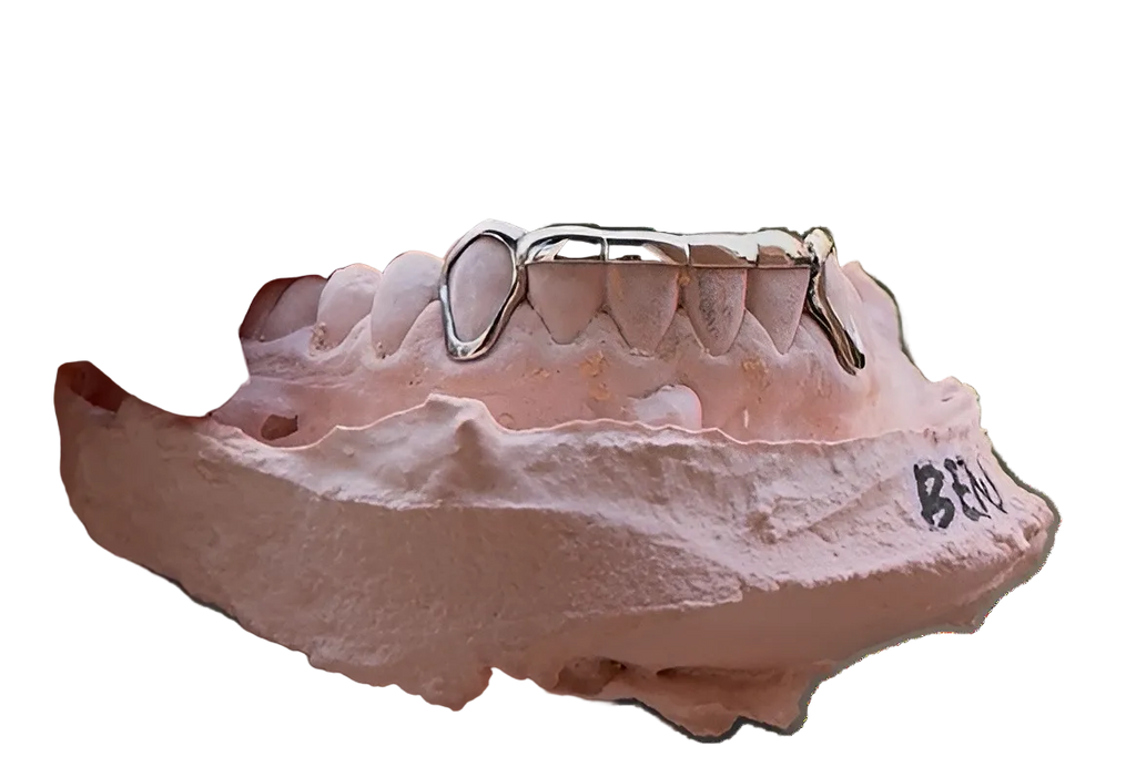 Grillz cromo London Bridge a medida - DELACRUZ GRILLZ