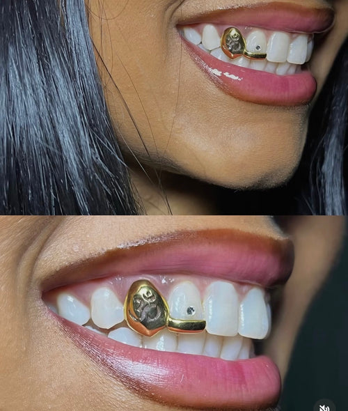 Grillz Baño de Oro Personalizado y Borde